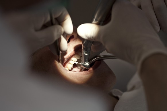 Dentist Martin von Ziegler polishes a patient&#039;s teeth after tartar removal in his dental practice in Zurich, Switzerland, pictured on April 6, 2010. (KEYSTONE/Gaetan Bally)

Zahnarzt Martin von Z ...