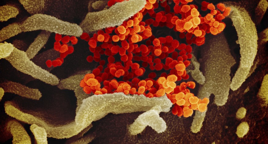 Was du zum Coronavirus wissen musst – die wichtigsten Punkte