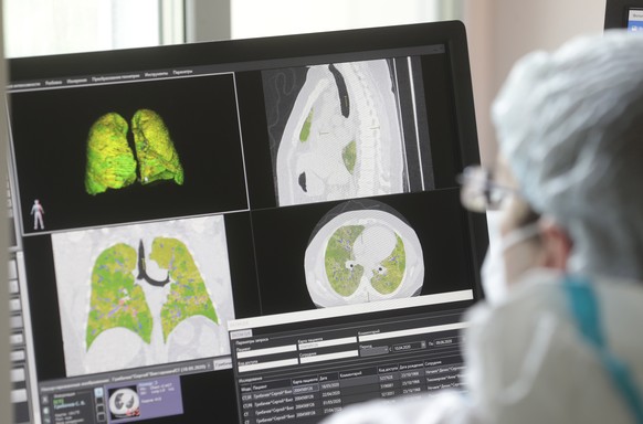 epa08477537 A hospital specialist watches a monitor showing a specially designed software for better visualization of computed tomography of the lungs at the profiled for treatment of Covid-19 and pne ...