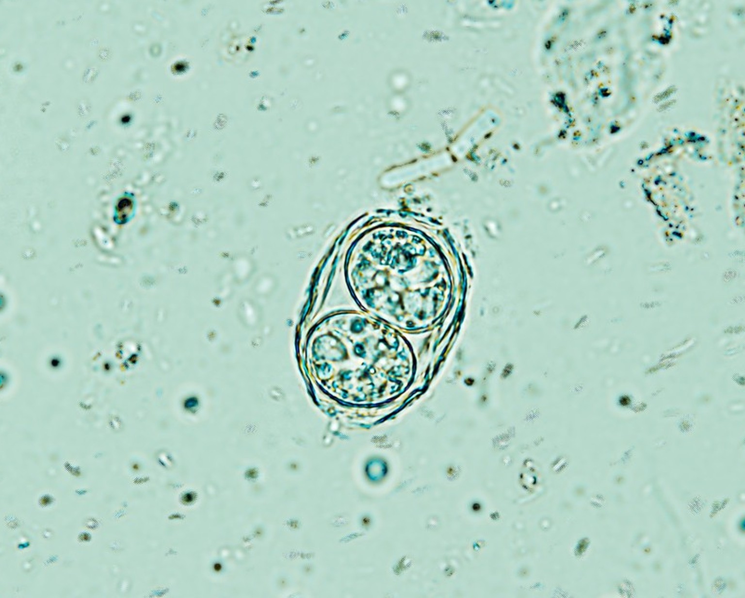 Oozyste von Toxoplasma gondii
