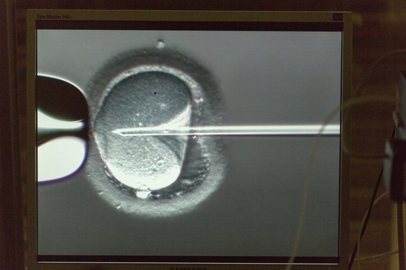 Injection of a spermatozoon into a an ovum (ICSI: Intra Cytoplasmic Sperm Injection), at the ward for reproductive medicine of the University Hospital of Bern, Switzerland, on May 12, 2015. (KEYSTONE/ ...