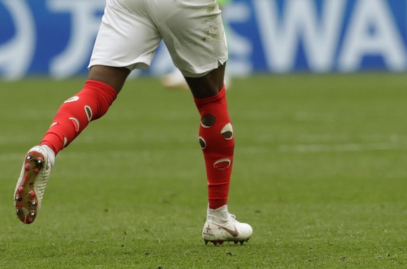 England&#039;s Danny Rose wears socks with holes cut in them, supposedly to prevent cramps, during the third place match between England and Belgium at the 2018 soccer World Cup in the St. Petersburg  ...