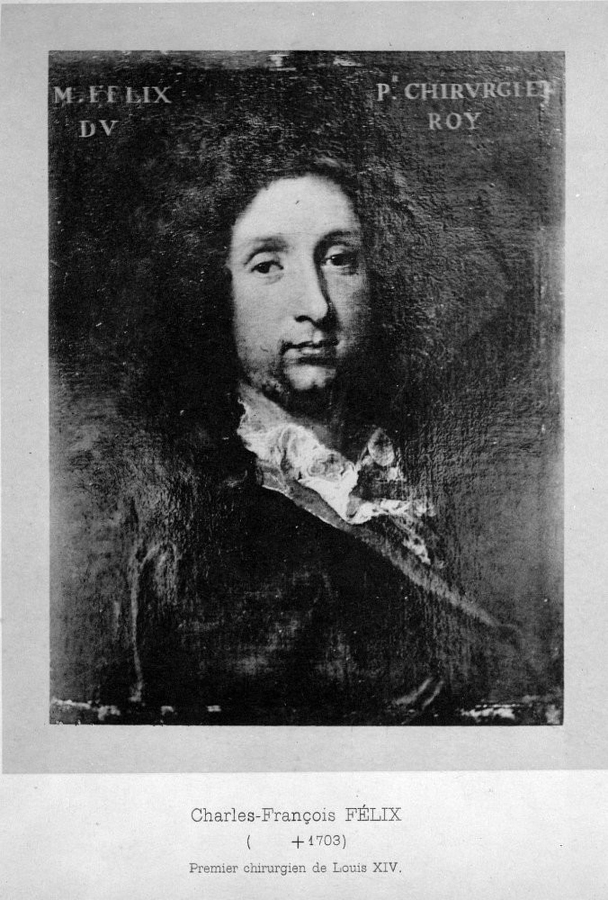 Der königliche Chirurg und Fistel-Entferner Charles-Francois Félix de Tassy.bild: wikimedia