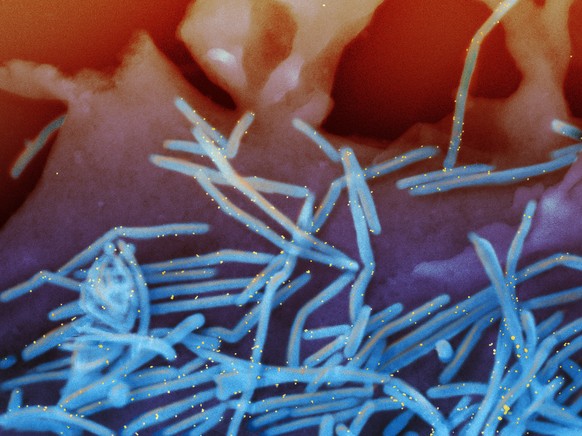 This electron microscope image, provided by the National Institutes of Health, shows human respiratory syncytial virus (RSV) virions, colored blue, and anti-RSV F protein/gold antibodies, g...