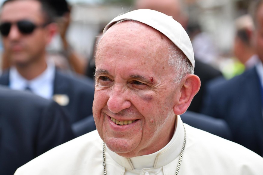 epa06196975 Pope Francis, showing a bruise around his left eye and eyebrow caused by an accidental hit against the popemobile&#039;s window glass while visiting the old sector of Cartagena, is greeted ...