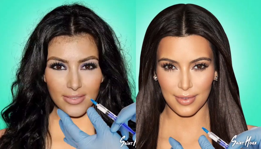 Eine Spritze geht um in den Gesichtern der Kardashians: Die zauberhafte Verwandlung von Kim & «Co»