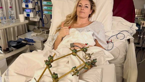Olympia 2026: Lindsey VOnn meldet sich nach 3. Operation aus dem Spital