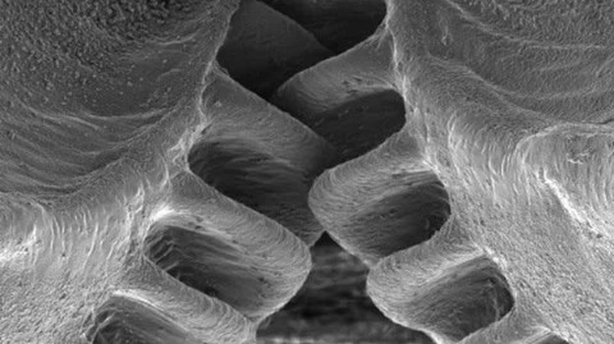Zahnräder bei der Insektenart Issus coleoptratus.