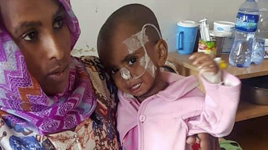 Selam Mulu, 2, is treated for malnutrition at the Ayder Referral Hospital in Mekele, in the Tigray region of northern Ethiopia, Tuesday, Oct. 4, 2022. Babies are dying in their first month of life at  ...