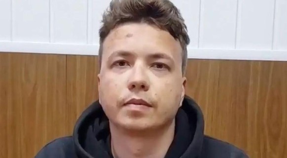 So sah Roman Protassewitsch am Tag nach seiner Verhaftung auf dem Minsker Flughafen aus. Sein Vater sagt, die Nase seines Sohnes sei ganz offensichtlich gebrochen.