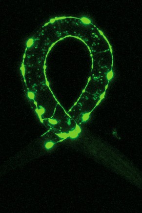 Das Nervensystem des Fadenwurms C. elegans.