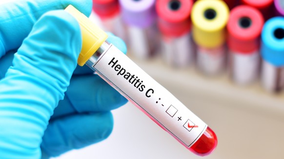 Hepatitis C