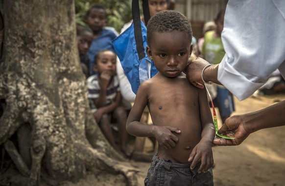 epa04946551 Four-year-old Bonne Chance gets a mid upper arm contour measurement to determine his nutrition status at a UNICEF supported community nutrition site in Fort Dauphin, Madagascar, 24 Septemb ...