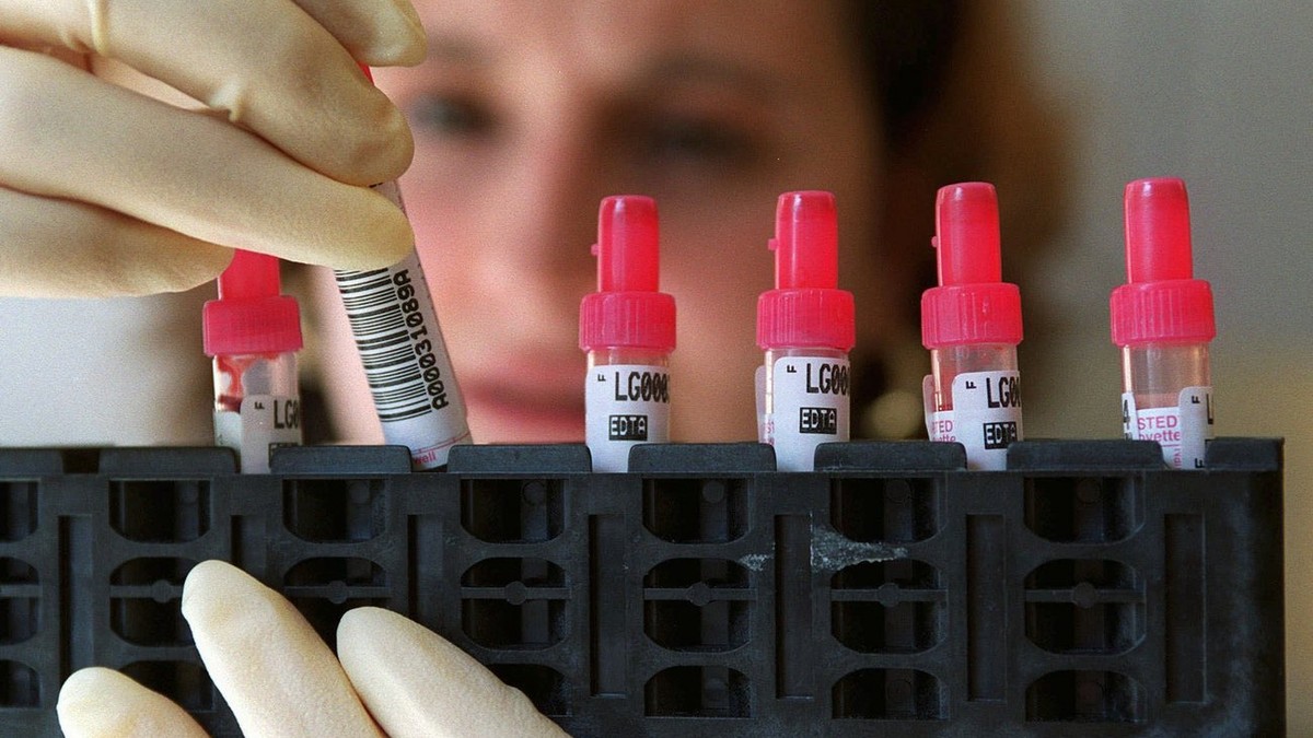 Une laborantine controle des echantillons de sang avant leur analyse, ce mardi 21 mars 2000 dans les locaux du laboratoire d'analyse medicale AMS a Lausanne. Le Laboratoire s'occupe notammen ...