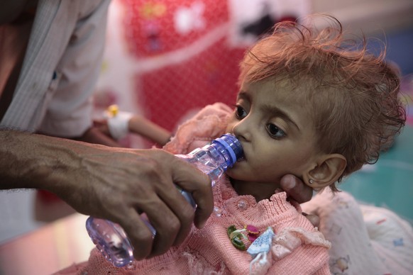 In this Thursday, Sept. 27, 2018 photo, a father gives water to his malnourished daughter at a feeding center in a hospital in Hodeida, Yemen. With US backing, the United Arab Emirates and its Yemeni  ...