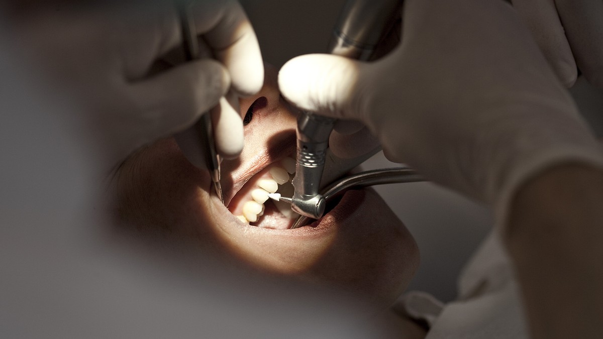 Dentist Martin von Ziegler polishes a patient's teeth after tartar removal in his dental practice in Zurich, Switzerland, pictured on April 6, 2010. (KEYSTONE/Gaetan Bally)

Zahnarzt Martin von Z ...