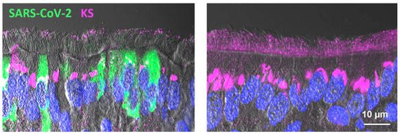 Fotos der Corona-Studie: &quot;SARS-CoV-2 infection of airway cells causes intense viral and cell shedding, two spreading mechanisms affected by IL-13&quot;