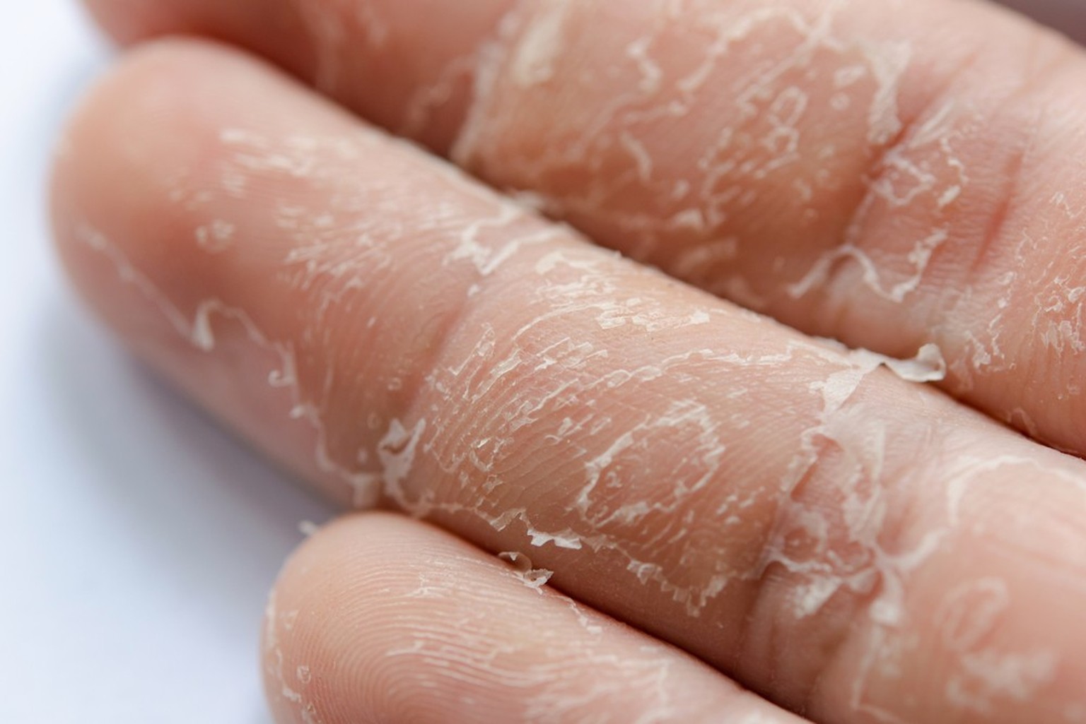 Menschliche Haut, Finger