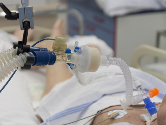 Coronavirus, Covid-19, künstliche Beatmung, Beatmungsgerät: Intubierter Patient auf Intensivstation