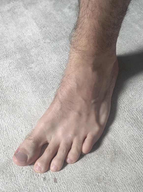 Flipflop oder nicht? das sind die schönsten Watson Füsse