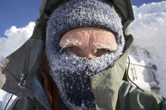 Frostbite, Erfrierung, Erfrieren, Kalt, Kälte, Eis