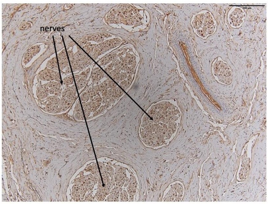 Aufnahme der Nerven in einer Delfinklitoris
https://plan.core-apps.com/eb2019/abstract/fc3c5a76-2dab-4997-af46-25f331877a19