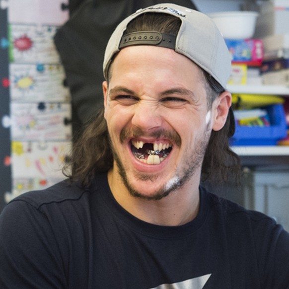 Dino Wieser vom HC Davos zeigt seine Zahnprothese, bei einem Besuch auf der Kinder- und Jugendabteilung des Kantonsspitals Graubuenden, am Mittwoch, 18. November 2015, in Chur. (KEYSTONE/Gian Ehrenzel ...