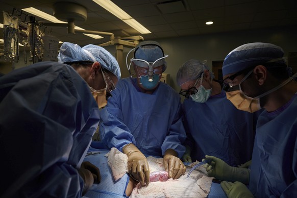 In this September 2021 photo provided by NYU Langone Health, a surgical team at the hospital in New York examines a pig kidney attached to the body of a deceased recipient for any signs of rejection.  ...