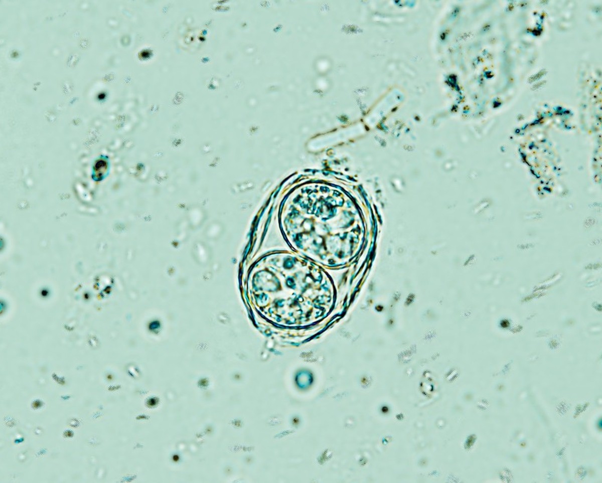 Oozyste von Toxoplasma gondii