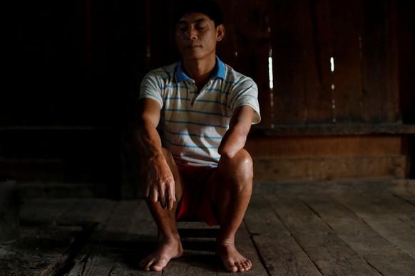 Mr. Soud, 40, who was injured by an unexploded bomb dropped by the U.S. Air Force planes during the Vietnam War when he was 10 years old, sits in his house in the village of Kakho in Xieng Khouang pro ...