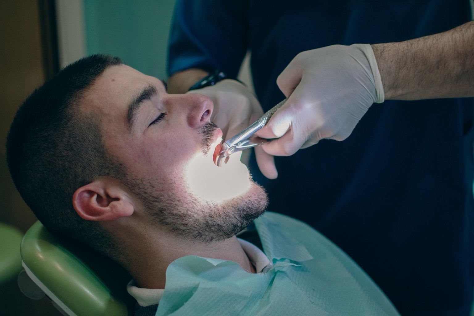 tooth extraction with forceps to the patient