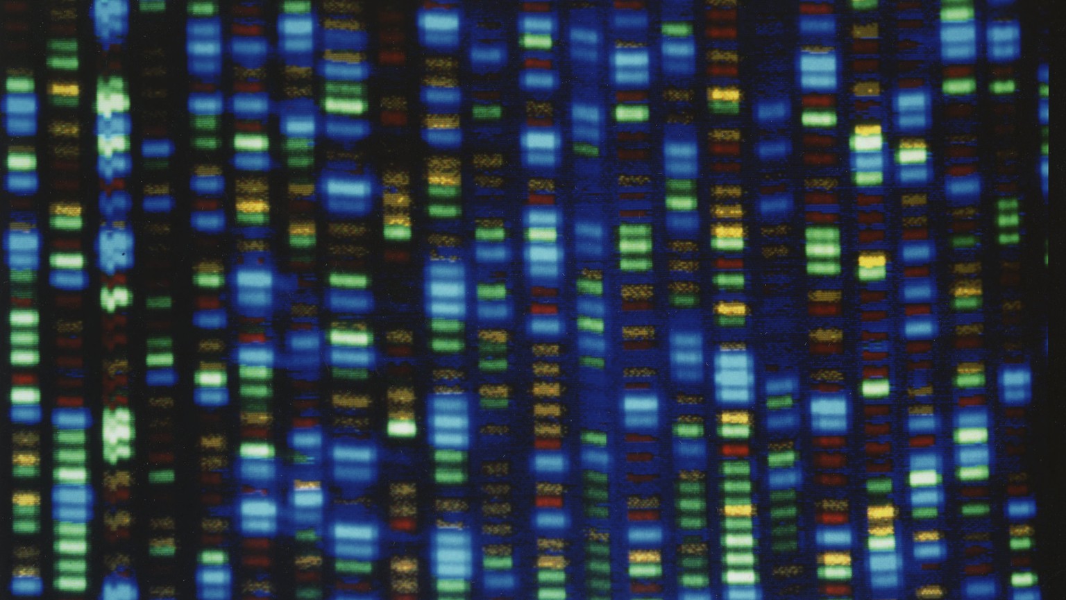 FILE - This undated image made available by the National Human Genome Research Institute shows the output from a DNA sequencer. The much-heralded Human Genome Project was a huge milestone for science, ...