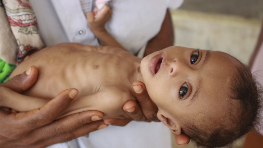 -Unertr-gliche-Folgen-Elf-Millionen-Kinder-im-Jemen-brauchen-Hilfe