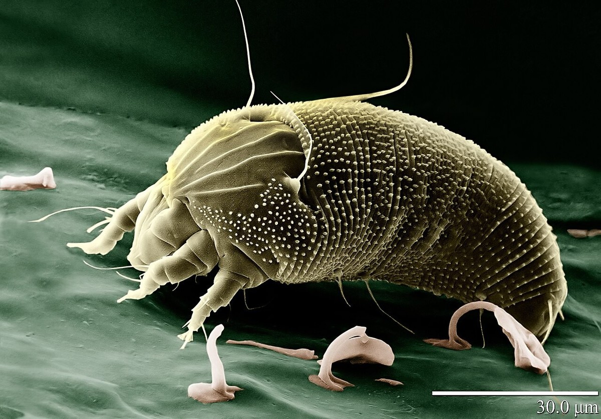 Die Gallmilbe Aceria anthocoptes.
https://de.wikipedia.org/wiki/Gallmilben#/media/Datei:Rust_Mite,_Aceria_anthocoptes.jpg