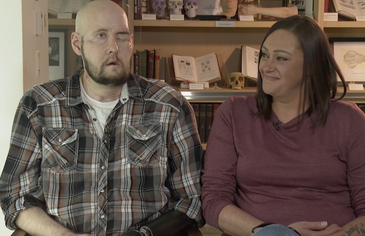 Aaron James speaks during an interview, accompanied by his wife, Meagan, in New York on Oct. 23, 2023. ?In his mind and his heart, it?s him _ so I didn?t care that, you know, he didn?t have a nose. Bu ...