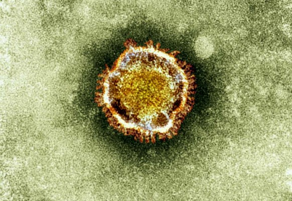 FILE - In this undated file image released by the British Health Protection Agency shows an electron microscope image of a coronavirus, part of a family of viruses that cause ailments including the co ...