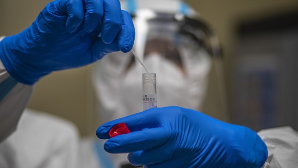 epa08696387 A medical worker takes a swab sample at a coronavirus testing station in Prague, Czech Republic, 25 September 2020. Czech Republic had record rise in COVID-19 disease caused by the SARS-Co ...