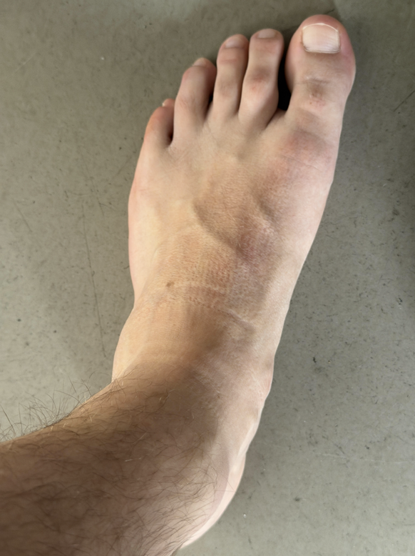 Flipflop oder nicht? das sind die schönsten Watson Füsse