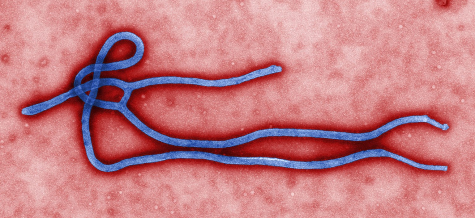 Das Ebola-Virus.