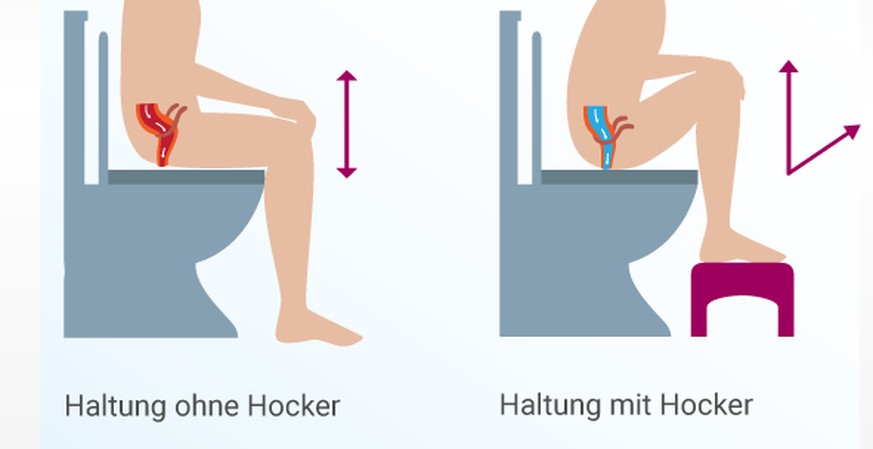 Und nun die wichtigste Frage des Tages: Wie gesund sind Toilettenhocker?