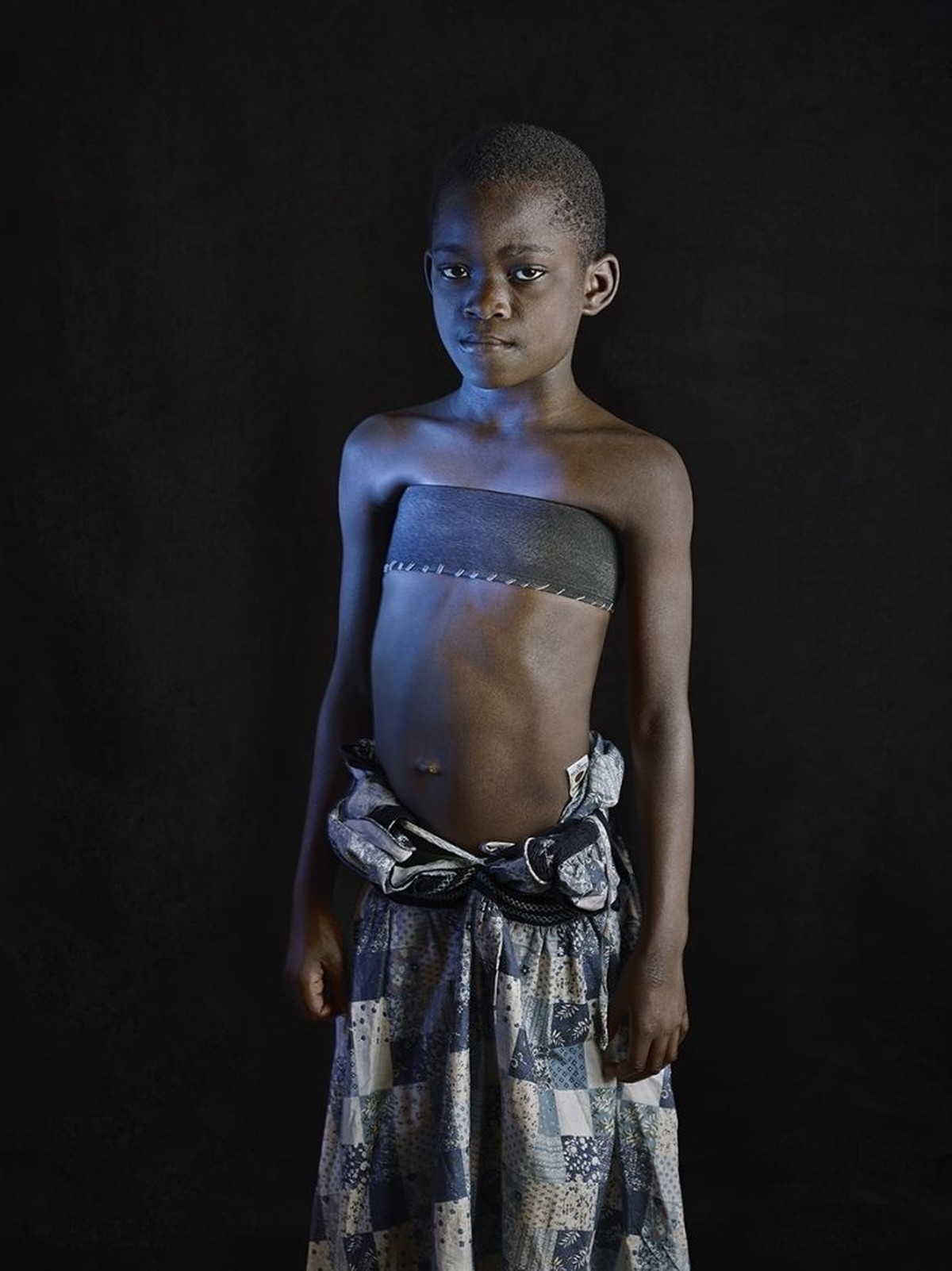 Breat Ironing, Brustbügeln, Brustbandage
https://omgvoice.com/lifestyle/breast-ironing-west-africa/