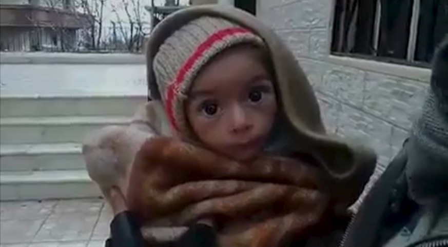 Abgemagert: Ein hungerndes Kind in Madaya.