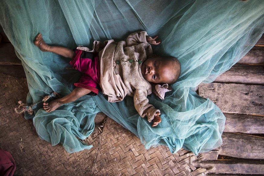 epa04942685 Eight month old Kajy Marcelline lies on the floor at his home in Amboasary, Madagascar, 21 September 2015. According to reports a severe food and nutrition crisis is effecting southern Mad ...