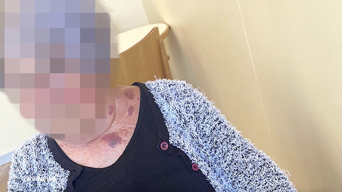 Angriff-auf-Pflegeheim-Bewohnerin-Er-wollte-mich-t-ten-