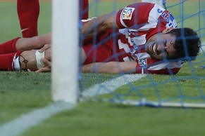 Diego Costas Schienbein nach dem Zusammenprall.