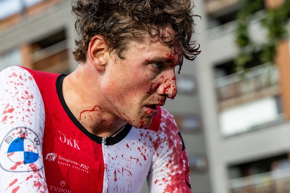 Swiss Stefan Kung of Groupama-FDJ pictured with blood on his white sleeve and face, after a heavy fall during the elite men individual time trial at the UEC Road European Championships, a 29,5km track ...
