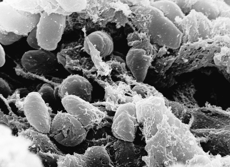 Undated handout image provided by Rocky Mountain Laboratories showing an electron micrograph depicting a mass of Yersinia pestis bacteria (the cause of bubonic plague). (AP Photo/Rocky Mountain Labora ...