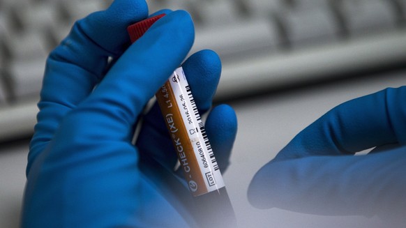 FILE - In this May 24, 2016 file photo, an employee of the Russia&#039;s national drug-testing laboratory holds a vial in Moscow, Russia. The World Anti-Doping Agency has turned over evidence from 43  ...