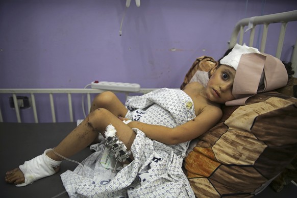 Kenzi al Madhoun, a four-year-old who was wounded in an Israeli bombardment, lies on a bed at Al Aqsa Hospital in Deir al Balah, Gaza Strip, on Nov. 1, 2023. (AP Photo/Abdel Kareem Hana)