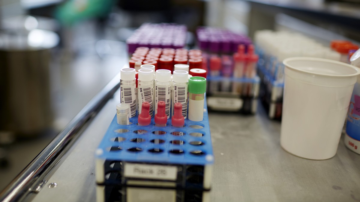 ARCHIV -- ZUM ZUKUENFTIG ERGAENZENDEN HEPATITIS E TEST BEI SPENDERBLUT, STELLEN WIR IHNEN AM MITTWOCH, 27. JUNI 2018, FOLGENDES BILDMATERIAL ZUR VERFUEGUNG -- Patientenroehrchen warten waehrend der Du ...